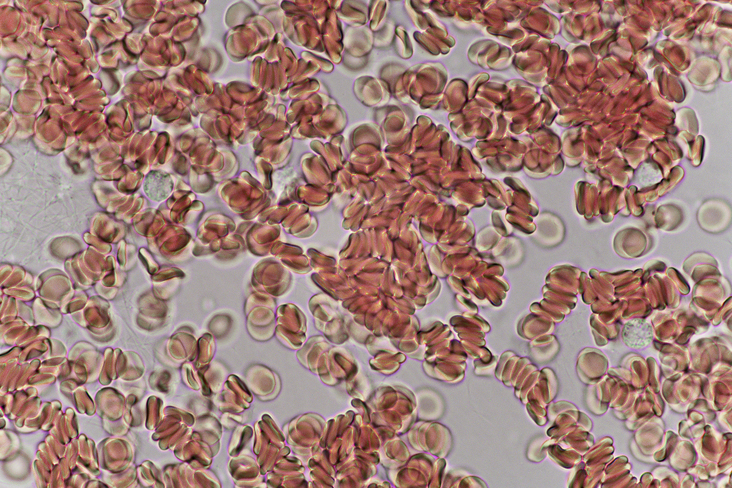 expanded photography